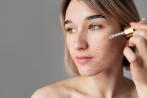 Anti acne serum